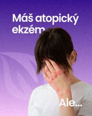 Atopický ekzém si vyžaduje trpezlivú a pravidelnú starostlivosť 🤍 Okrem hydratácie pokožky zvonka nezabúdaj ani na podporu...